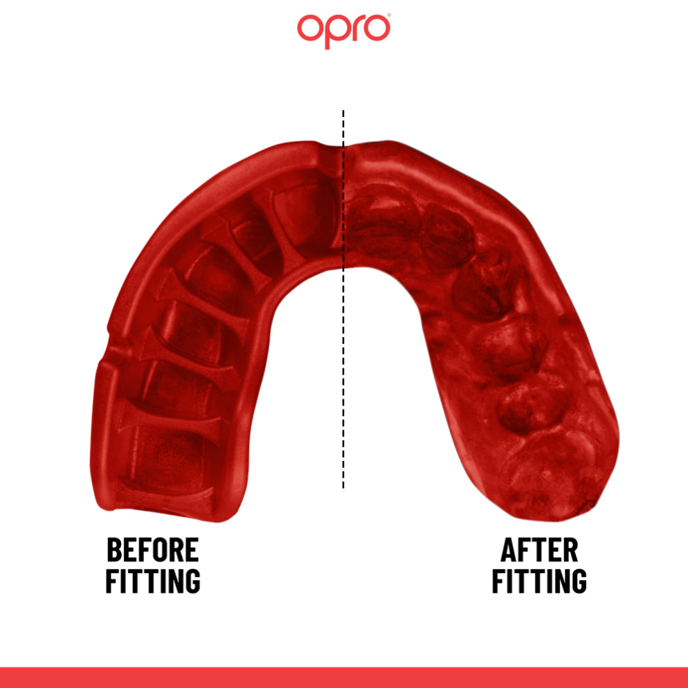 OPRO Self-Fit GEN5 Gold Mouthguard